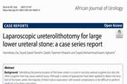 Laparoscopic ureterolithotomy for large lower ureteral stone: a case series report